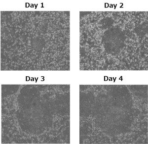 PCME-System hiPSC (human induced pluripotent stem cells) PCME-System hiPSC (human induced pluripotent stem cells)